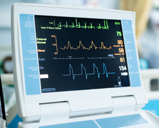 macchina ecg